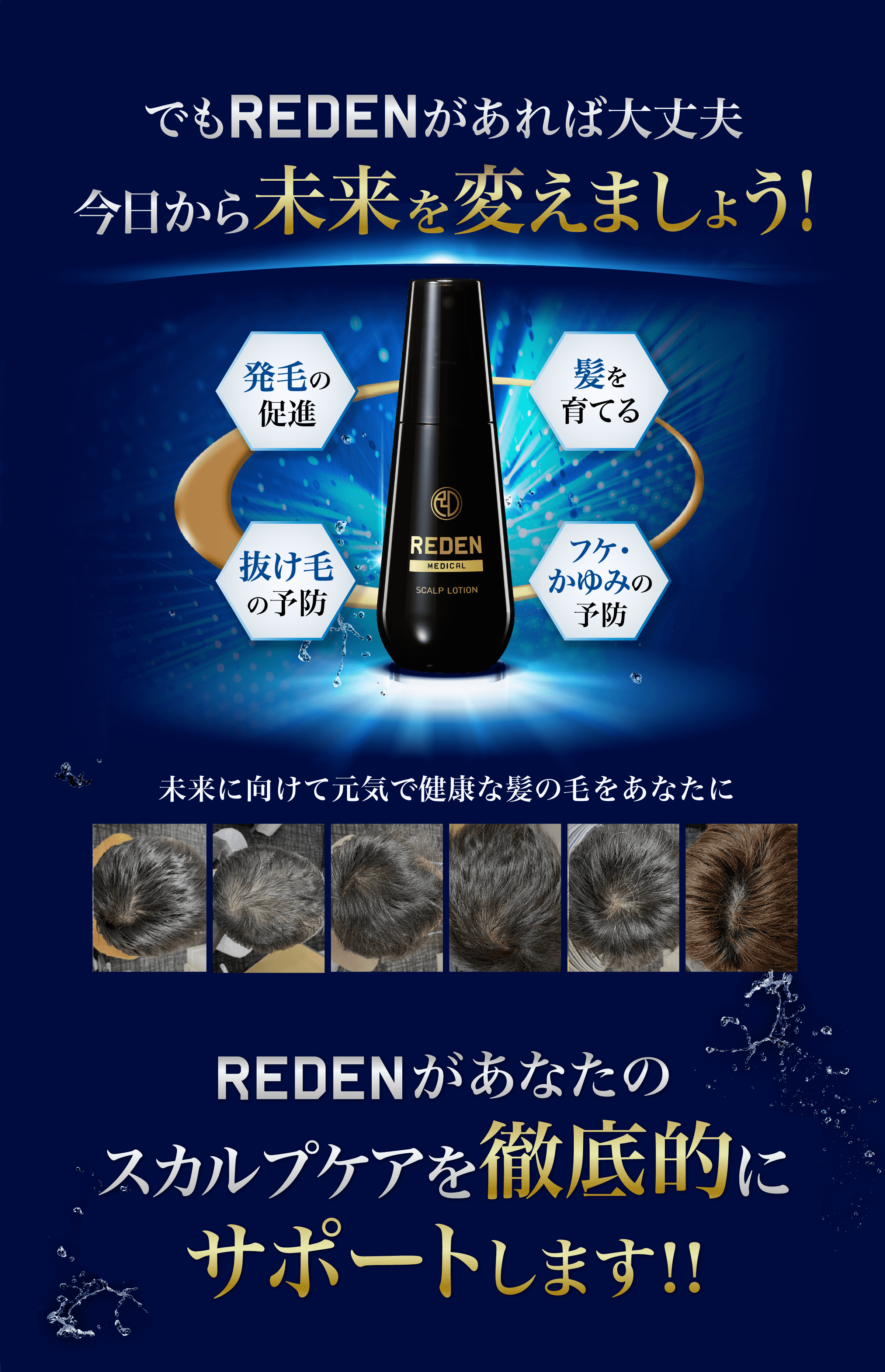 でもREDENがあれば大丈夫今日から未来を変えましょう